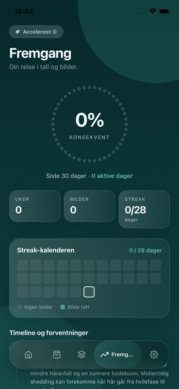 Acceleroot-appen – fremgangsvisning med konsistens og streak-kalender